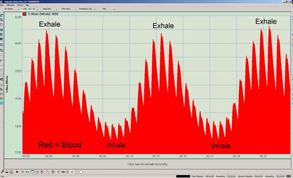 valsalva_wave_for_susanne.JPG